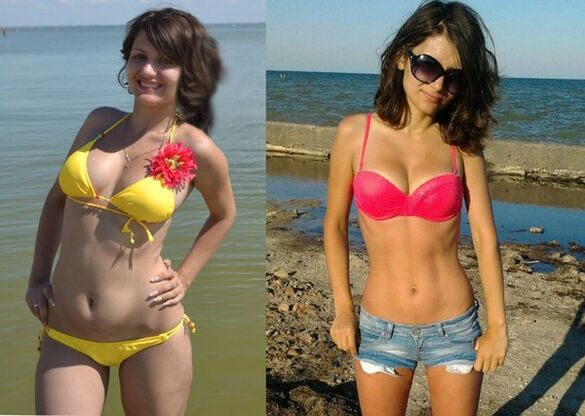 Anna schudła 10 kg dzięki NexaSlim